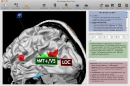 BrainVoyager QX miniatyrbilde