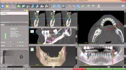 coDiagnostiX thumbnail