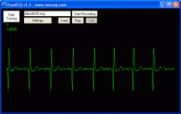 FreeECG miniatyrbilde