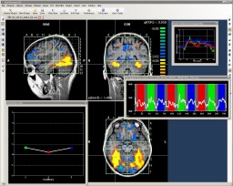 Turbo-BrainVoyager miniatyrbild