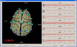 Visualization Toolkit (VTK) miniatyrbilde